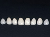 Взаимодействие врача и зубного техника при эстетической реставрации зубов цельнокерамическими коронками и фарфоровыми многослойными винирами