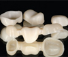 Изготовление высокоэстетичных реставраций при использовании циркониевых колпачков на депульпированных зубах, восстановленных литыми вкладками